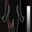 Bloody Wounds 7